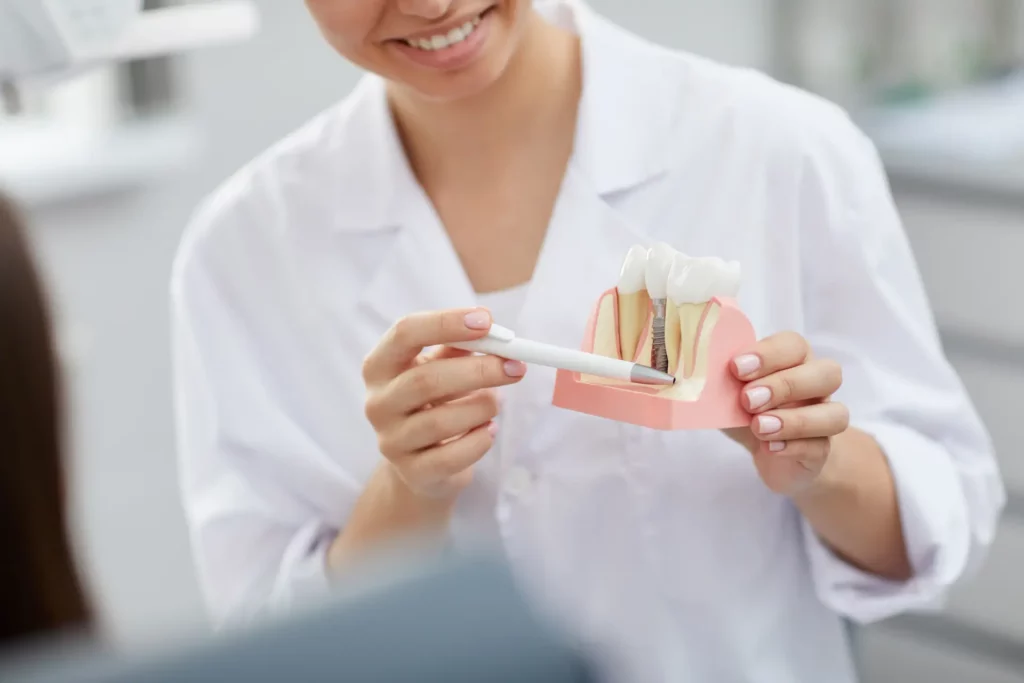 torque test dental implant