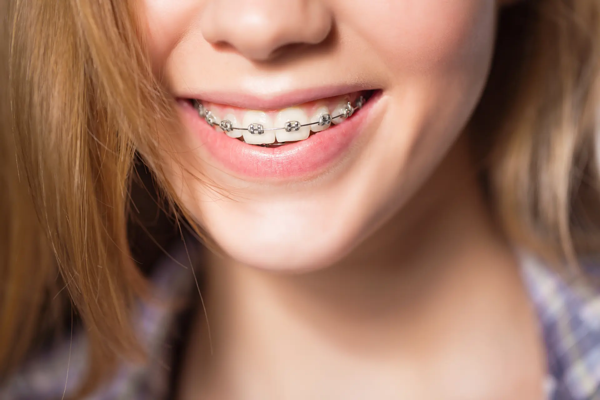 Can I Get Braces After a Dental Implant? Understanding Dental Implants