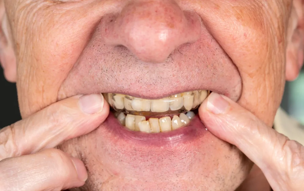 old man with stained teeth