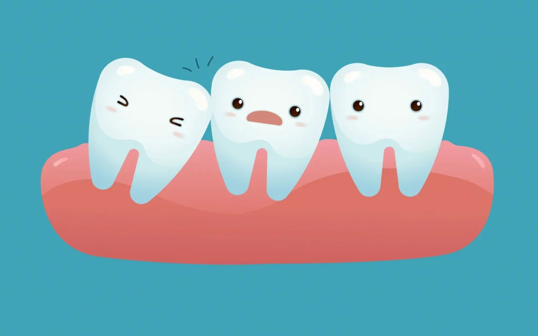 Understanding Impacted Teeth Causes, Symptoms, Treatment, and Care